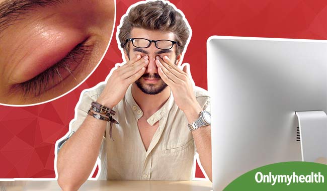 आंखों की सूजन, दर्द और थकान को दूर करते हैं ये आसान घरेलू नुस्खे